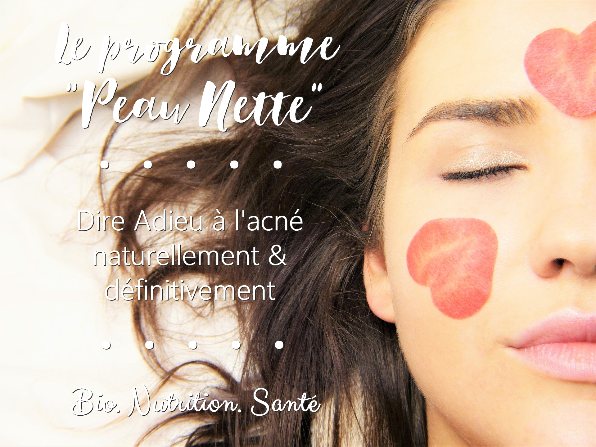 programme coaching anti-acné Peau Nette - Bio Nutrition Santé