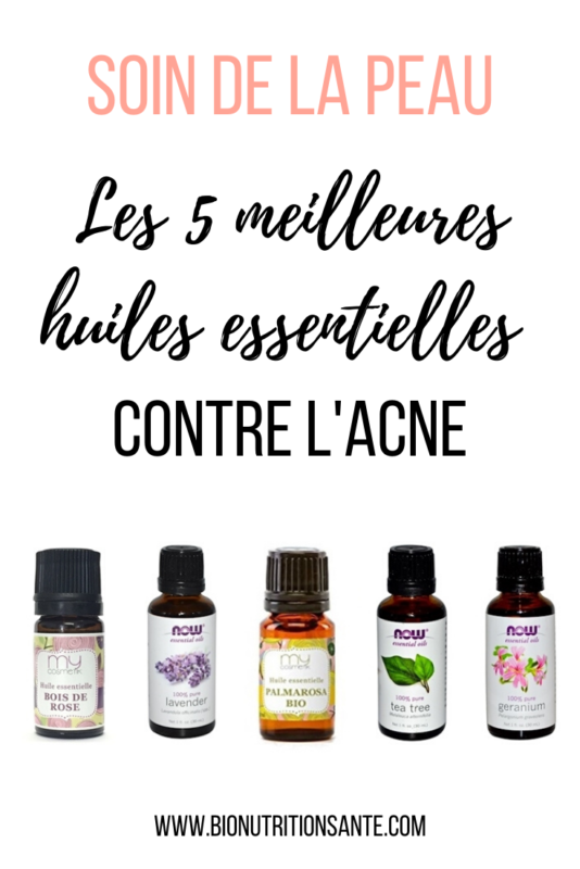 les 5 meilleures huiles essentielles contre l'acné